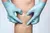 Spider Veins